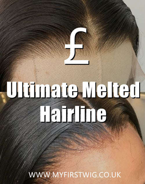 Ultimate Melted Hairline Service - XB